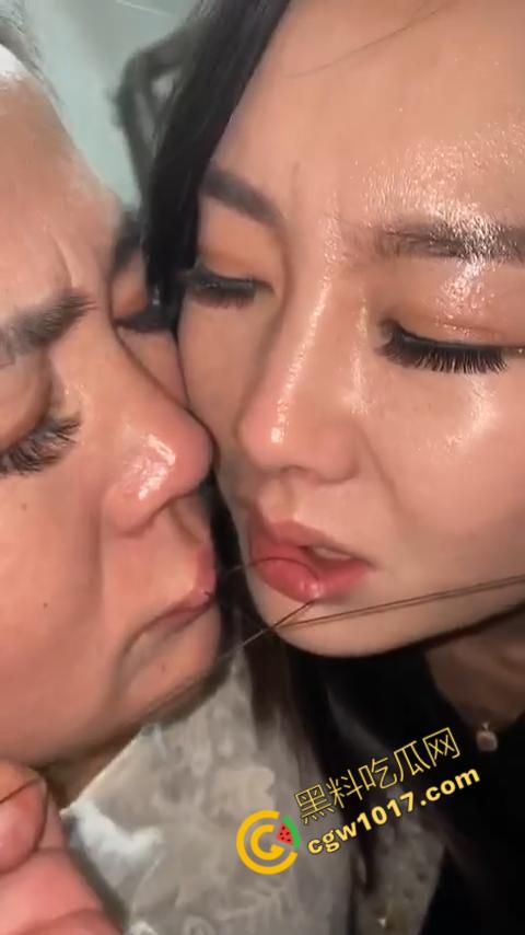 湖南偏僻村庄恐怖游戏：嘴唇缝合，女子痛苦享受，男子冷血针线，极限挑战人，真是够变态-8