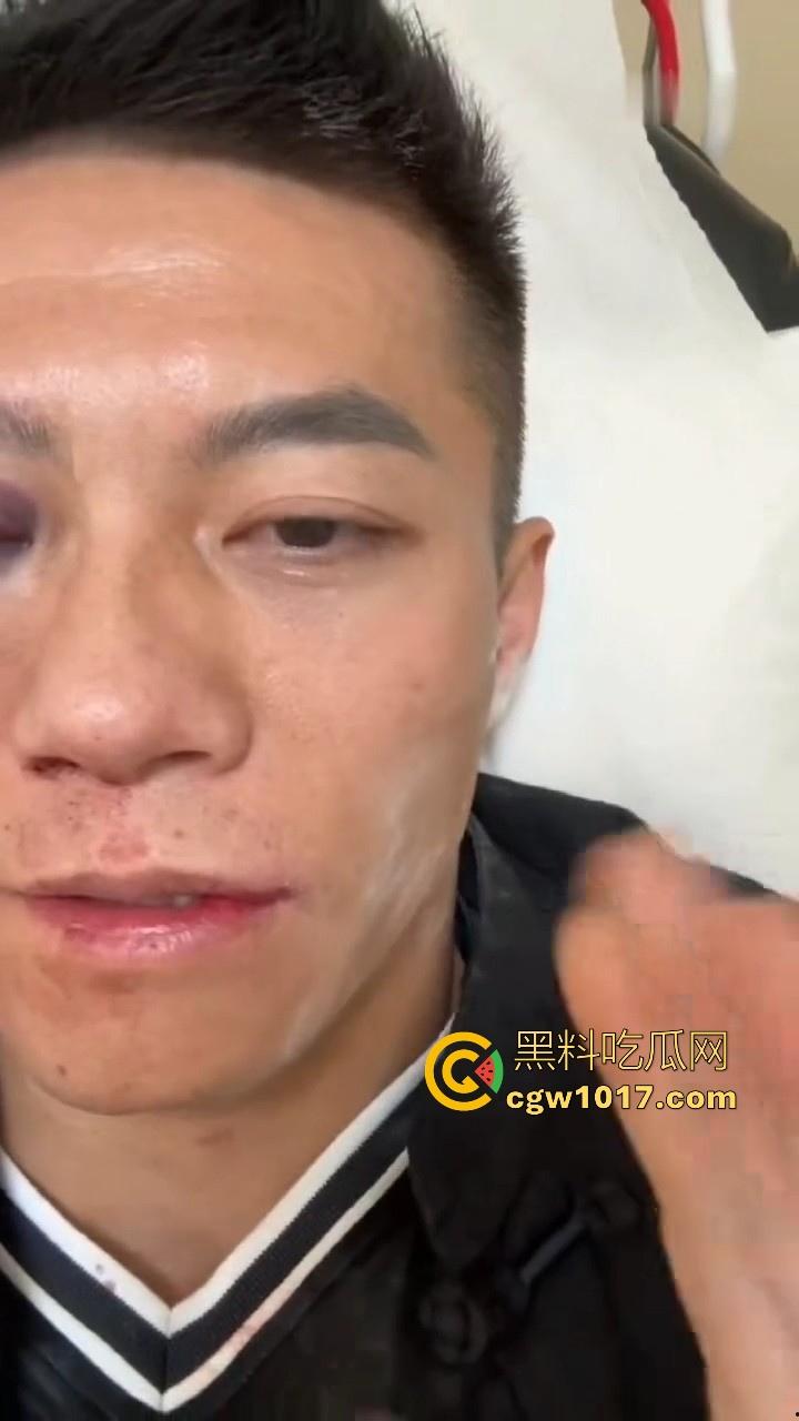 通背拳传人赵鸿刚参加UFC扇耳光大赛被对手KO！曾以为在耳光大赛上无敌的武功，没想到是这种下场，真是花拳秀腿！-10