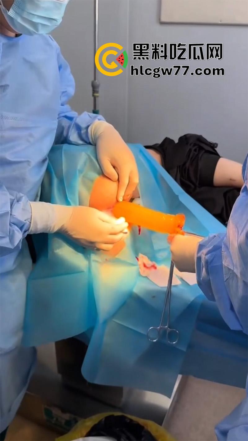 成都肛肠科又来新活，巨屌玩具塞入菊花拔不出来，只能到医院取出，这么大怎么塞进去的呢？-7