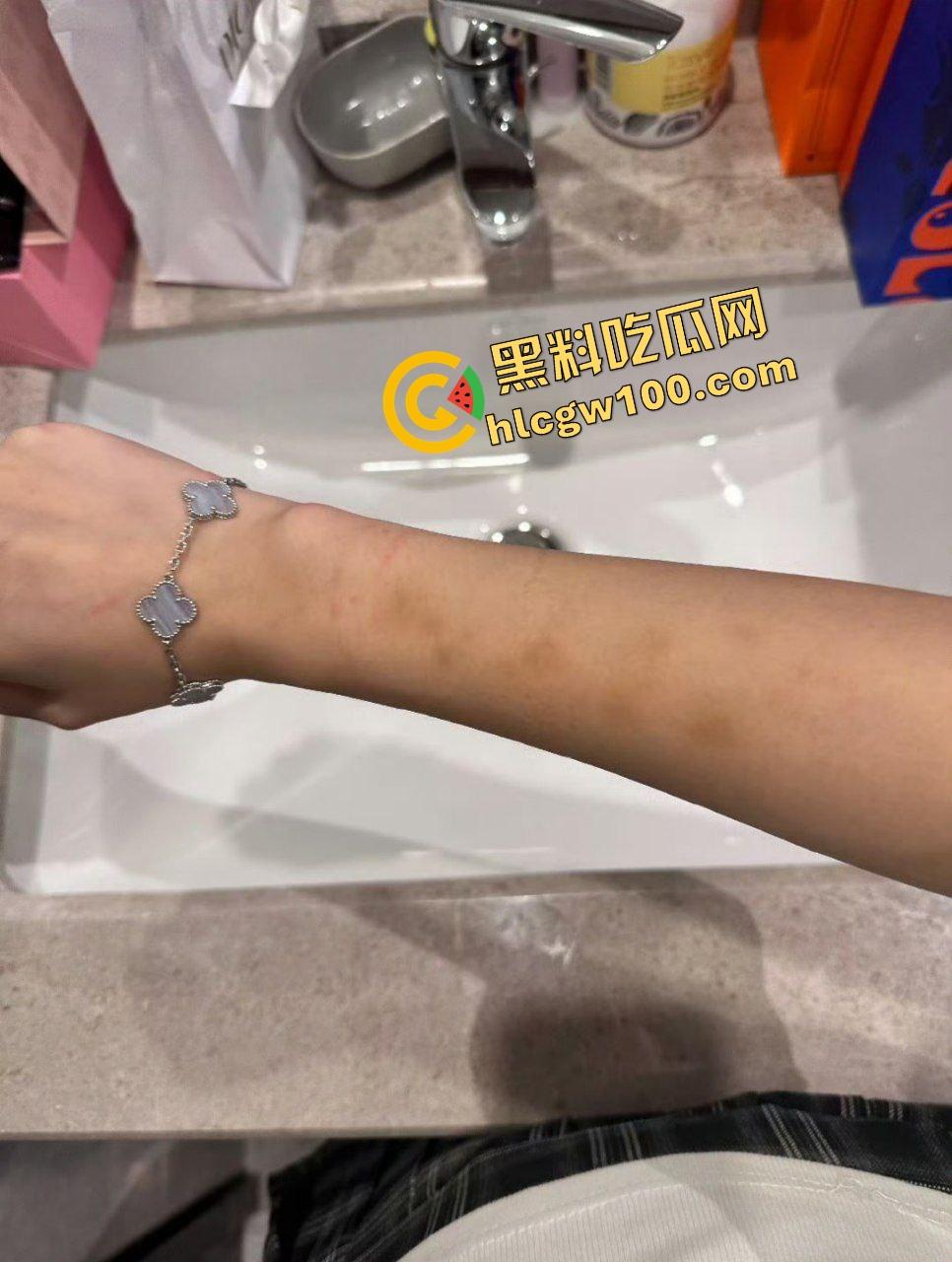 街球圈情侣大瓜！杭州街球手【程鑫凯】家暴女网红【鸡腿诺】多处打伤哭泣现场！独家开盒流出！-14