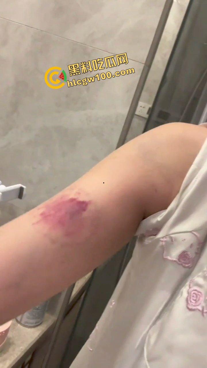 街球圈情侣大瓜！杭州街球手【程鑫凯】家暴女网红【鸡腿诺】多处打伤哭泣现场！独家开盒流出！-16