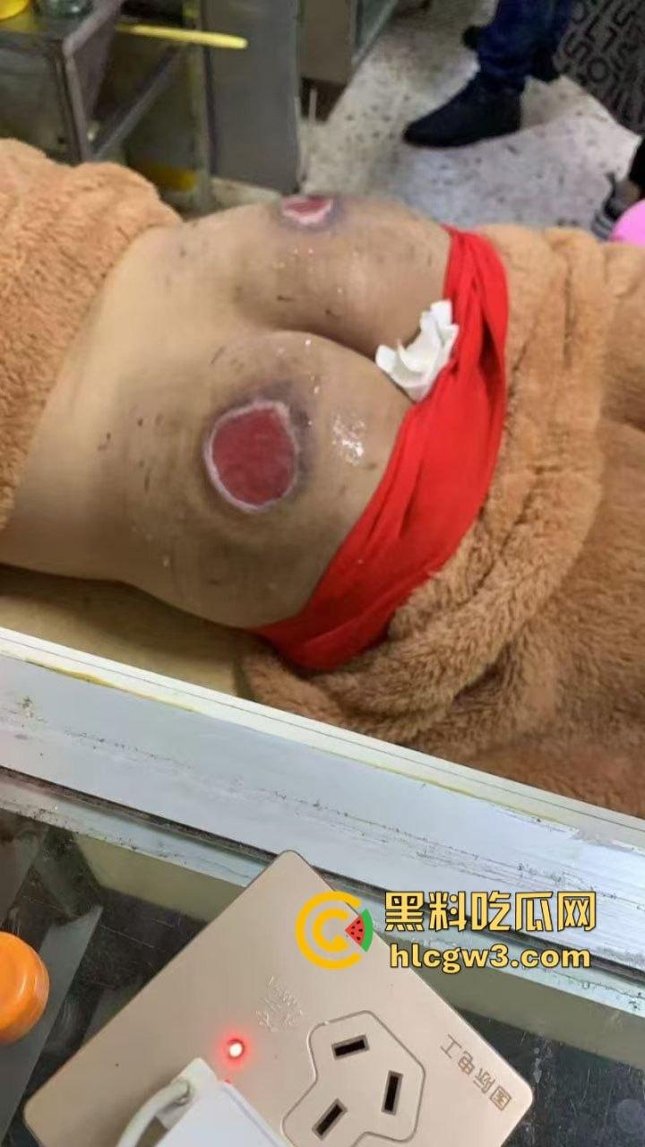 缅北电诈猪仔【陈锦和】失联4个月终获救 屁股惨遭电刑割肉伤疤惨不忍睹 真是炼狱一日游！-8