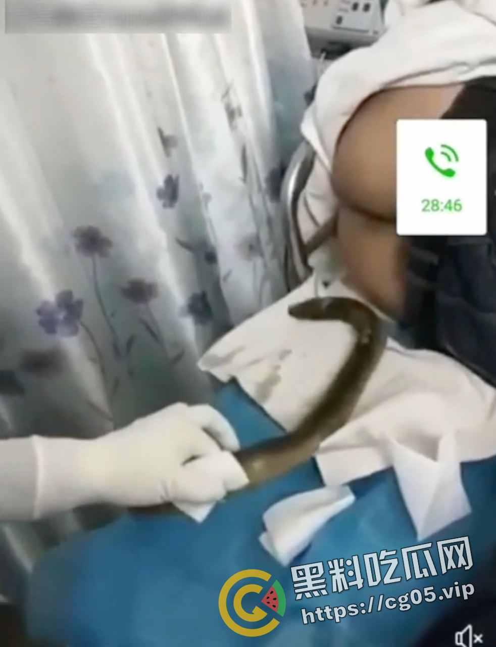 黄鳝入肛 一去不回 整活把自己整进医院了 医生扯出来半米长的黄鳝惊呆了-4