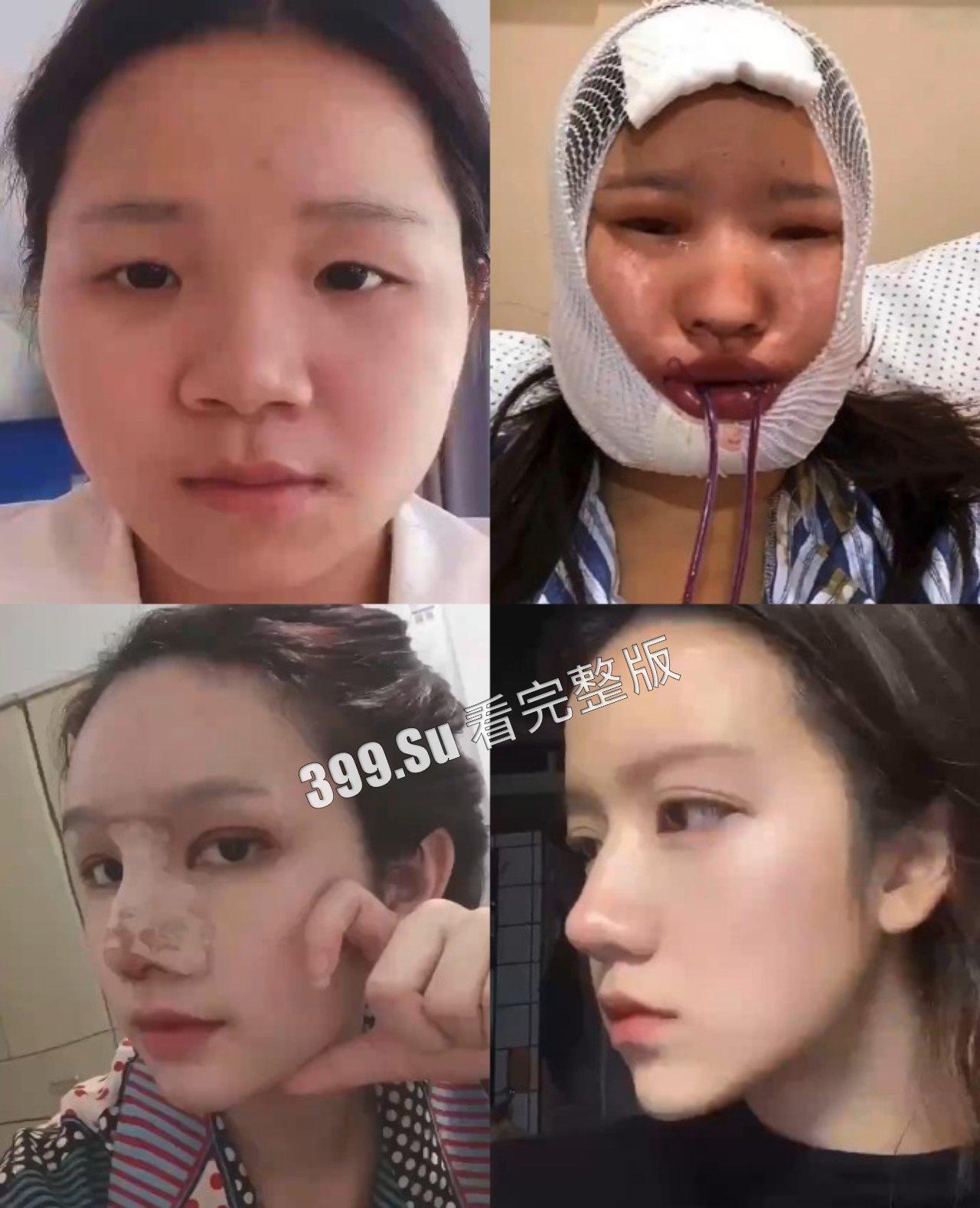 医美整形那些事儿  假的真不了  瓜友们能在生活中分辨出人造人吗？-1