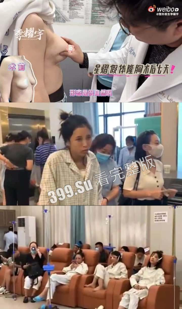 医美整形那些事儿 假的真不了 看的脸皮发麻 (三)-3