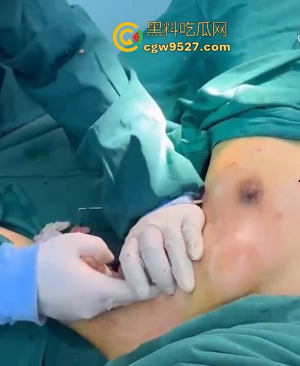 隆胸整形手术现场大曝光！平乳妹秒变巨乳御姐，手术过程一览无遗，女人为变美的代价真大！-7