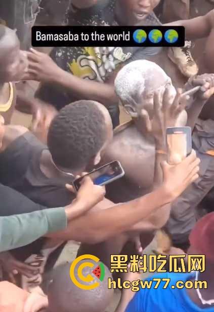 非洲部落割包皮 这也太生猛了吧 包皮一拉一刀下去直接割掉 这老哥全程面无表情!-5