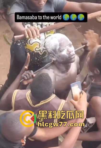 非洲部落割包皮 这也太生猛了吧 包皮一拉一刀下去直接割掉 这老哥全程面无表情!-6