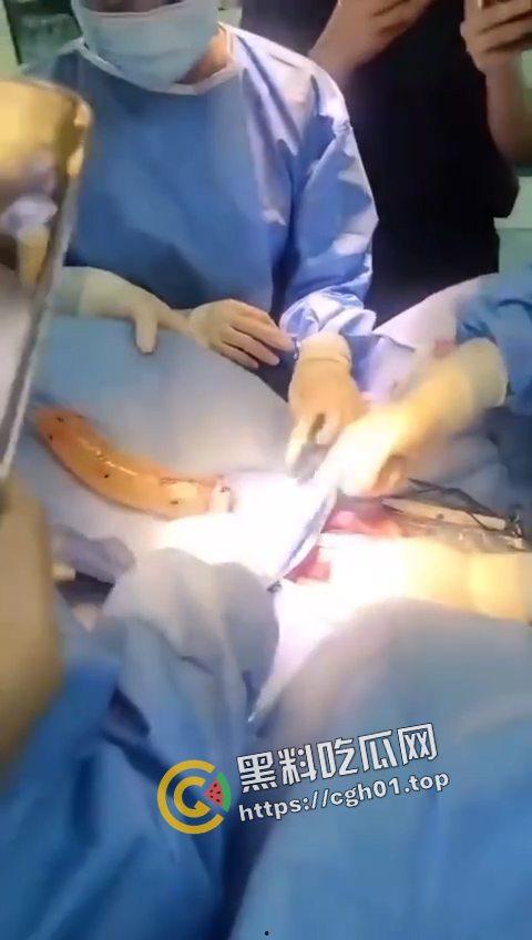 活久见!超大假阳具塞进体内拿不出来只能做手术 你们男同玩的都这么狠吗-1