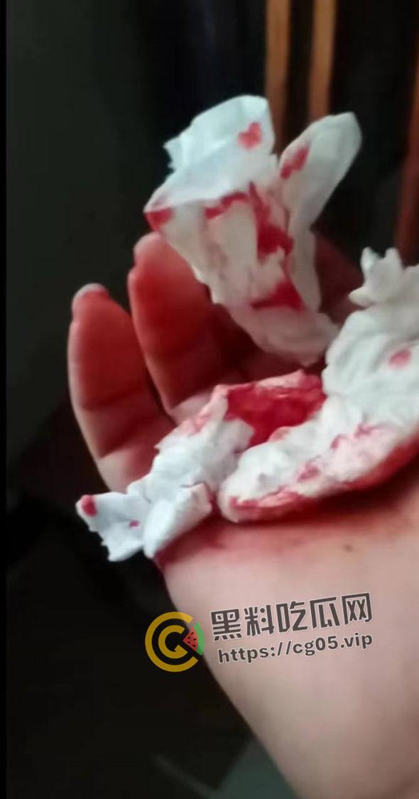 四川蓬安女子遭入户抢劫 微信里只有七百块也被抢走了 还说敢报警杀全家 现场遍地鲜血-5