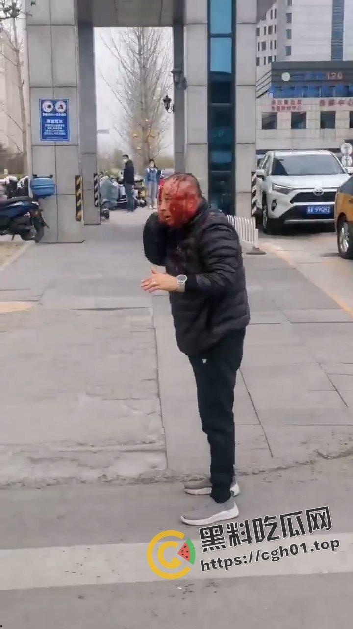 河北燕郊滴滴大战出租车！因为15元得单子出租车司机拿螺丝刀把滴滴司机脑袋捅烂 现场血腥画面流出-6